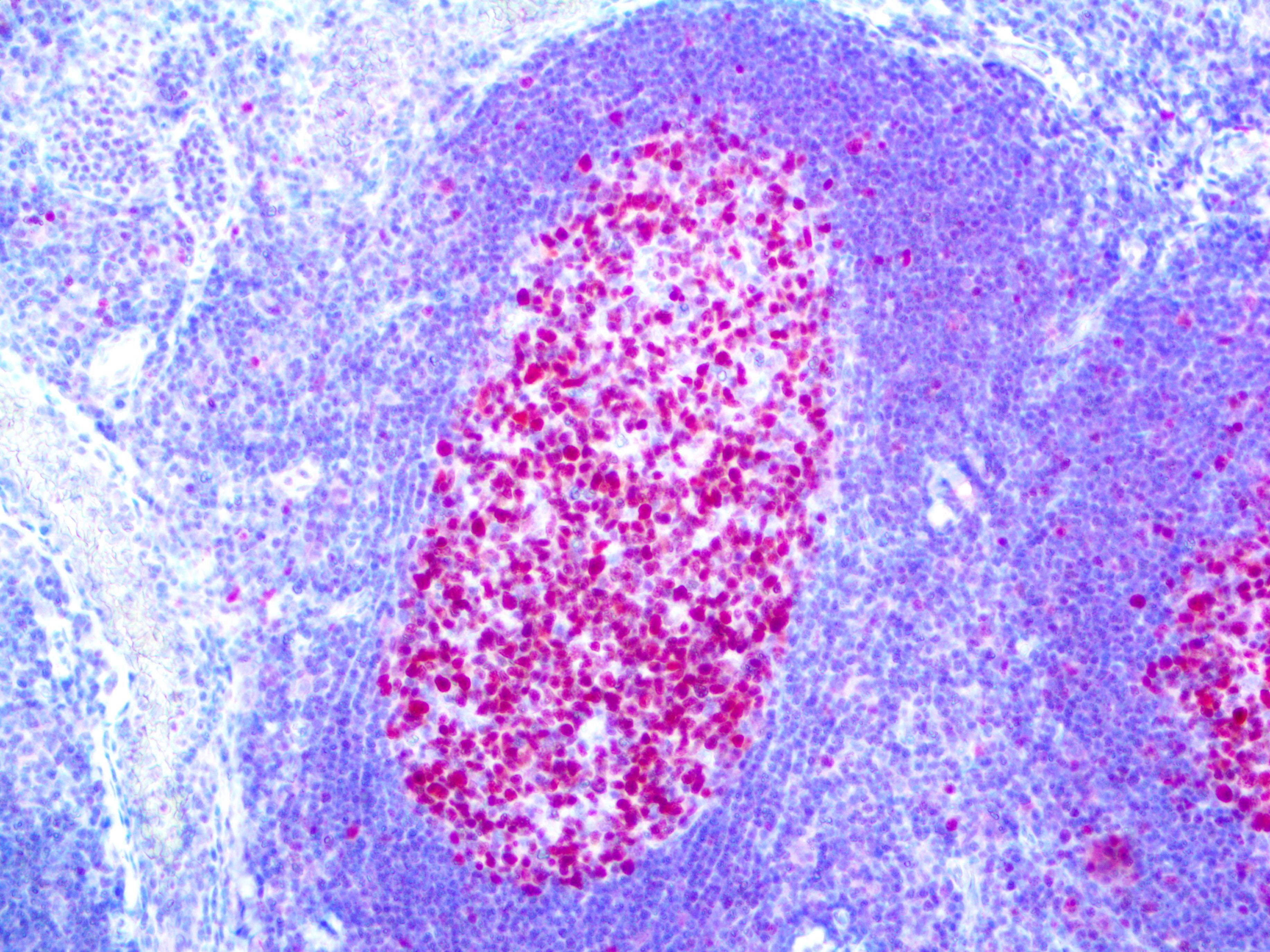 bcl-6 – RMab