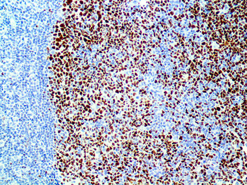 Bcl-6 – RMab