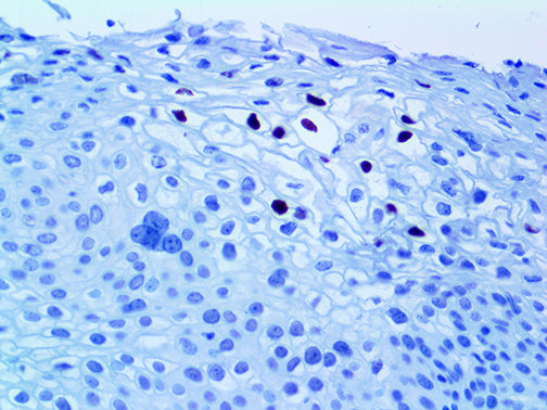 HPV16 – MMab