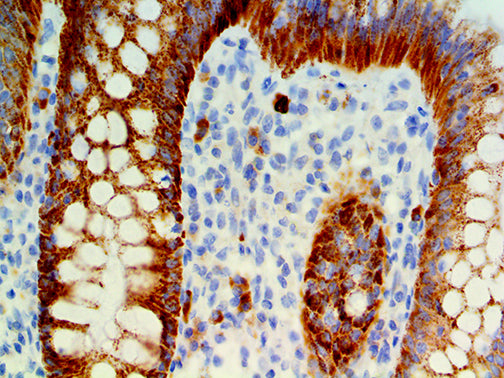 IMP-3 / IGF2BP3 – RMab