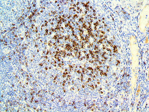 IgD – RMab