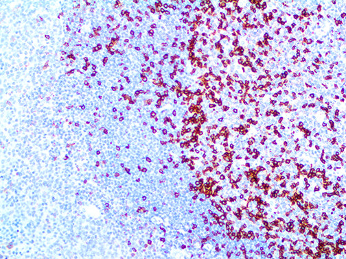 PD-1/CD279 – RMab