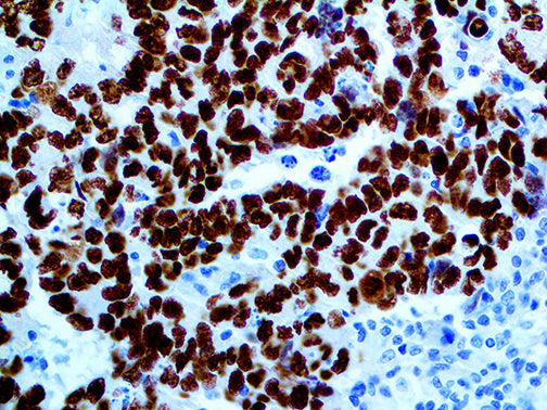 SALL4 – RMab