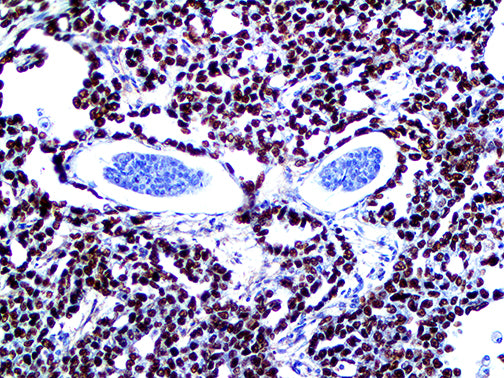 SALL4 – RMab