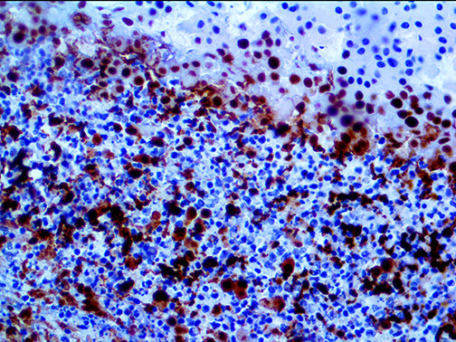 SMAD4/DPC4 – MMab