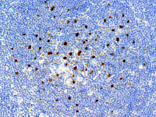 SOX-9 – RMab