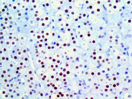 TFE3 – RMab