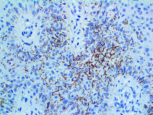 Treponema Pallidum – Polyclonal