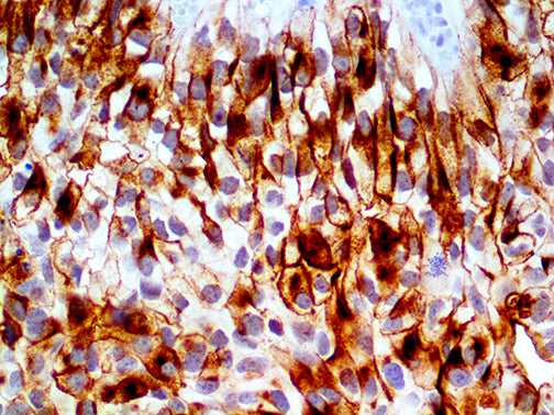 Uroplakin III – RMab