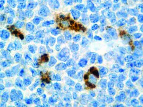 Alpha-1-Antichymotrypsin – Rabbit Polyclonal