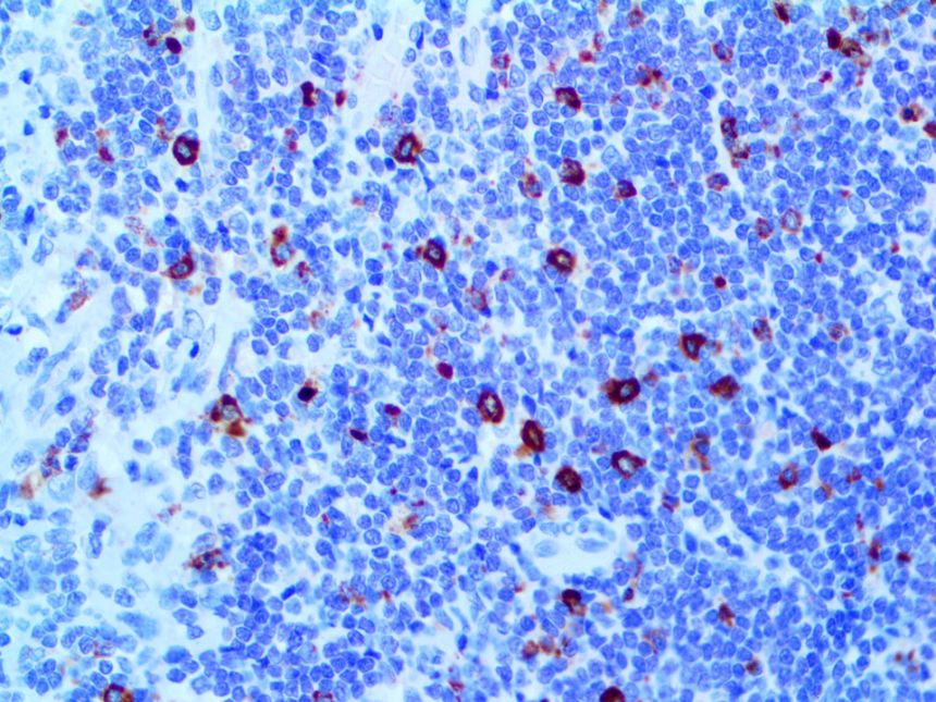 Alpha-1-Antichymotrypsin – Rabbit Polyclonal