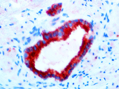 Alpha-Methylacyl-CoA Racemace – RMab