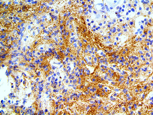 Alpha Synuclein – MMab