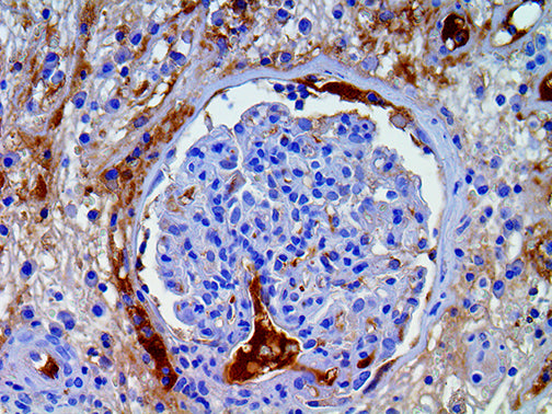 Amyloid A – RMab