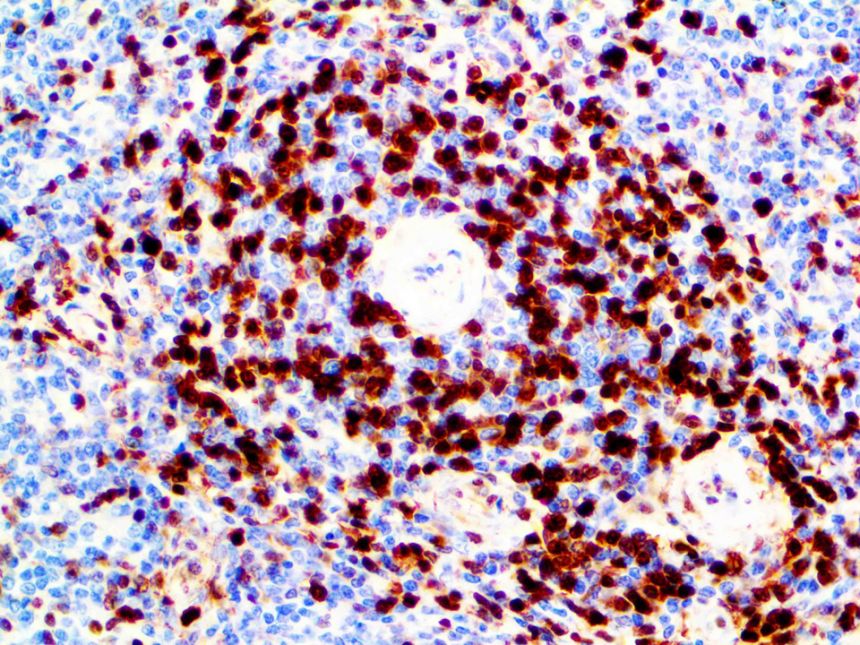 Annexin-A1 – MMab