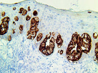 TintoFast EpCAM BerEP4 (Ber-EP4), MMab