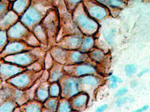 Beta-Catenin – MMab