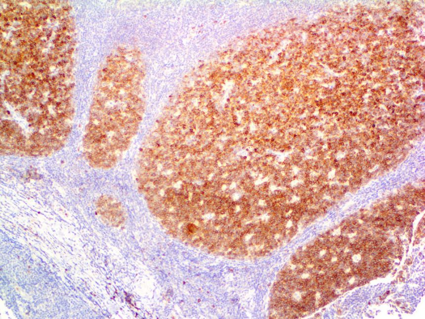 CD10 – RMab