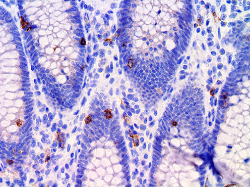 CD103 / ITGAE – RMab