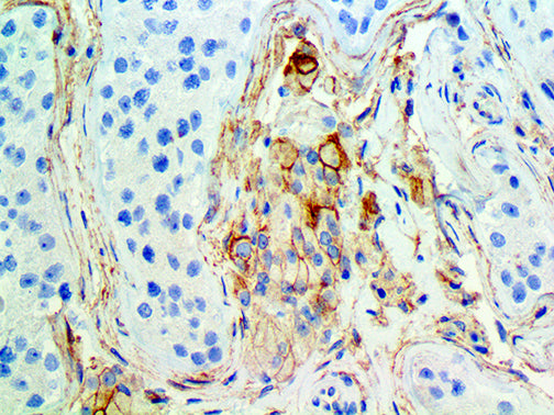 CD105 – RMab