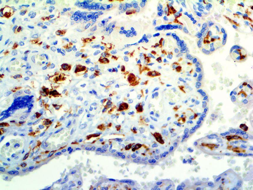 CD14 – RMab