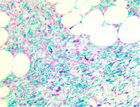 TintoFast CD34 (QBEnd/10), MMab