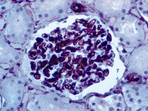 CD34 – MMab