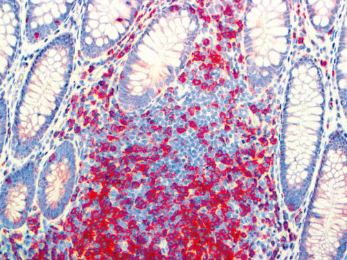 CD3 – RMab