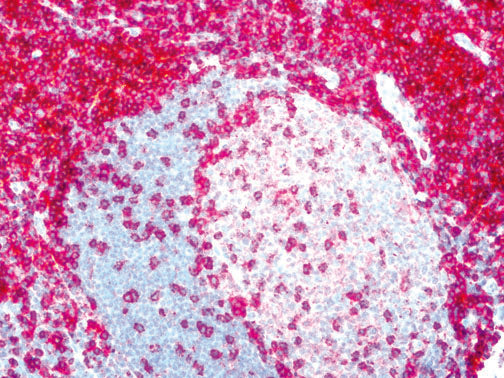 CD4 – RMab