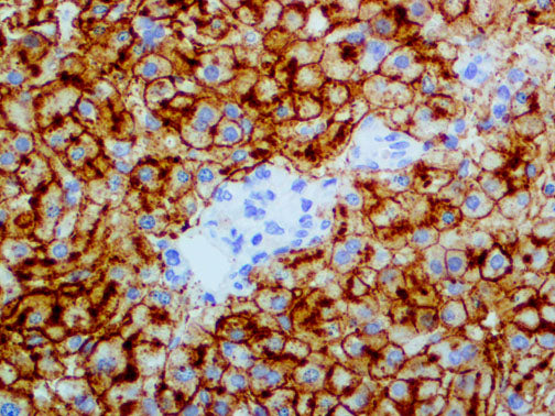 CD75 – MMab