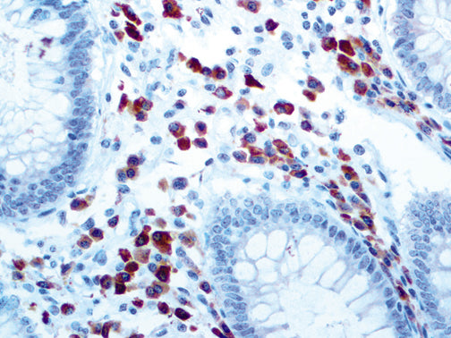 CD79a – MMab