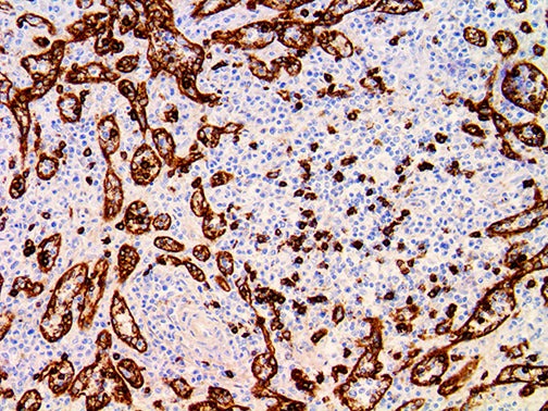 CD8 – RMab