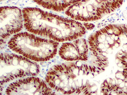 CDX2 – RMab