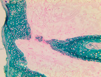 TintoFast Cytokeratin 5 & 6 (D5/16D4), MMab