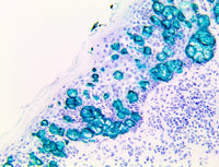 TintoFast Cytokeratin 7 (OV-TL 12/30), MMab