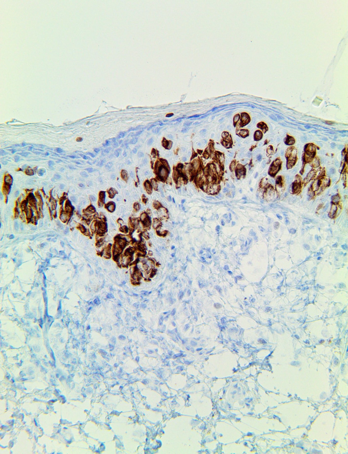 Mohs PolyDetector DAB HRP Brown Detection System