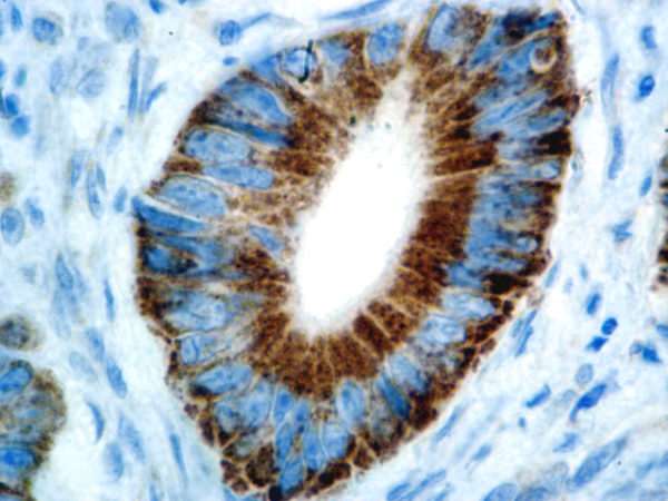 COX-2 – RMab