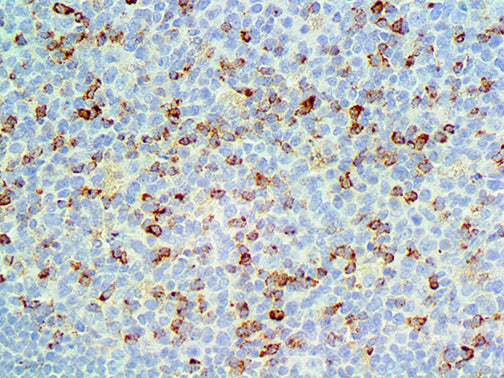 CTLA-4/CD152 – MMab