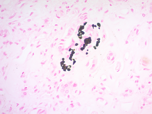 Calcium Stain Kit (Modified Von Kossa)