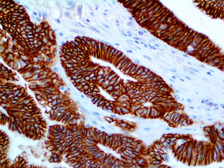 Cadherin-17 / LI-Cadherin – RMab