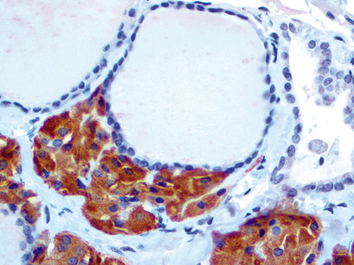 Calcitonin – Rabbit Polyclonal