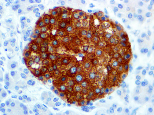 Chromogranin A – MMab