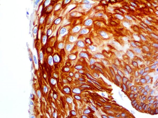 Cytokeratin 14 – MMab