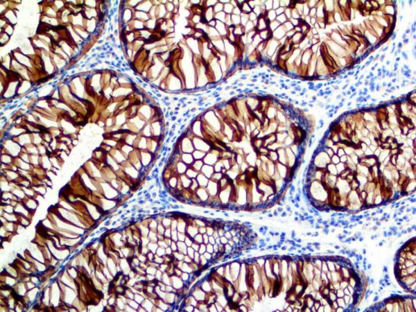 Cytokeratin 8 – RMab