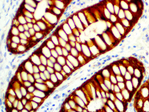 Cytokeratin Cocktail AE1 & AE3 – MMab