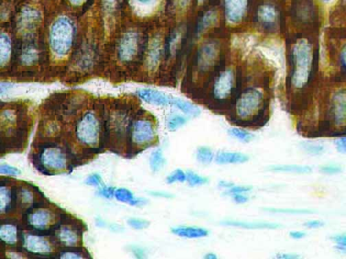 Cytokeratin HMW/AE3 – MMab