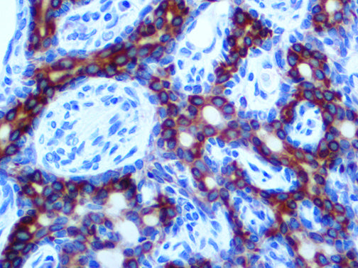 Cytokeratin LMW/AE1 – MMab