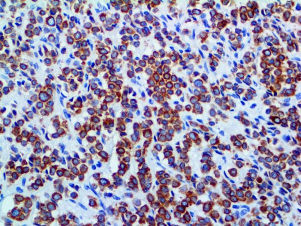 Cytokeratin LMW CAM5.2 – MMab