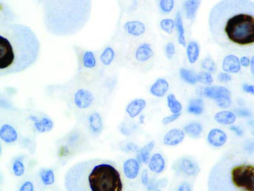 Cytomegalovirus – MMab