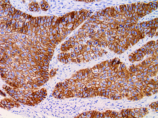Desmoglein-3 – RMab